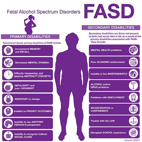 FASD Infographic